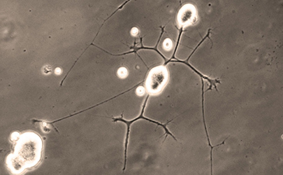 Axolotl Neuron Culture